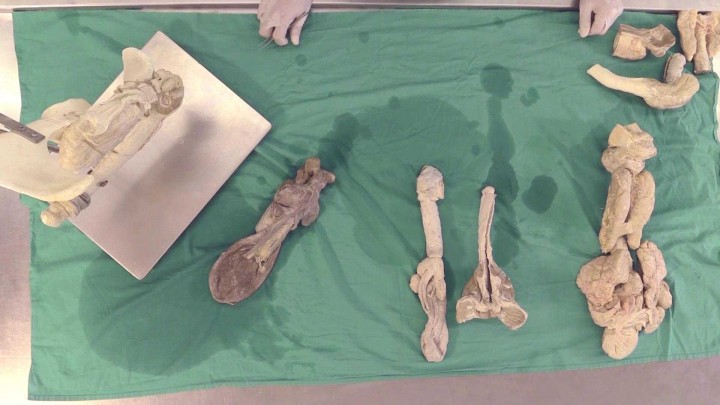 Anatomía comparada de las glándulas genitales accesorias