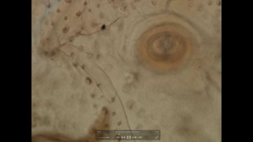 Video 06 - Observacion garrapata in toto (microscopio)