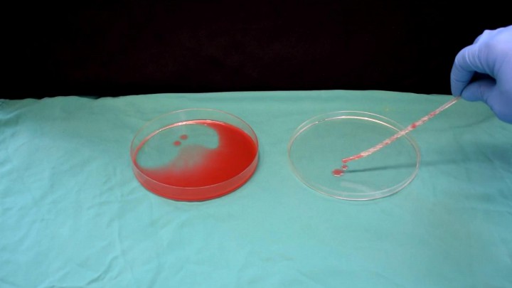 Dispositivo de recogida de fluido uterino