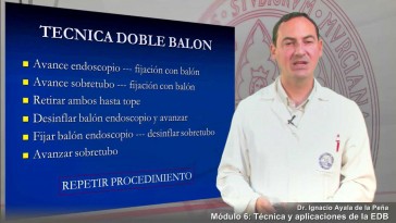modulo 6-3: Técnica endoscópica de doble balón (técnica y aplicaciones)