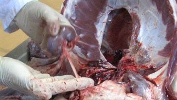 Extracción del sistema urogenital